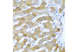 Immunohistochemistry of paraffin-embedded human liver using IFIT3 antibody (ABIN1680389, ABIN3018293, ABIN3018295 and ABIN6220427) at dilution of 1:100 (40x lens). (IFIT3 抗体  (AA 128-331))