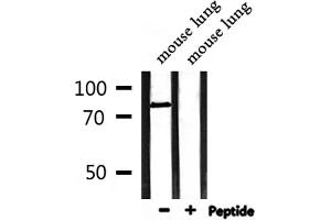 Western blot analysis of extracts from mouse lung, using MLH1 Antibody. (MLH1 抗体  (Internal Region))