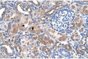 Immunohistochemical staining (Formalin-fixed paraffin-embedded sections) of human kidney with GALNT6 polyclonal antibody  at 4-8 ug/mL working concentration. (GALNT6 抗体  (N-Term))