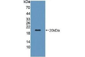 Detection of Recombinant PZP, Human using Polyclonal Antibody to Pregnancy Zone Protein (PZP) (PZP 抗体  (AA 1212-1391))