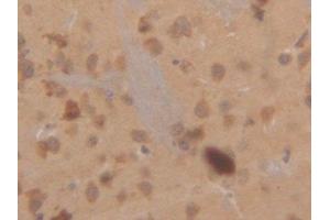 Detection of CK18 in Mouse Cerebrum Tissue using Polyclonal Antibody to Cytokeratin 18 (CK18) (Cytokeratin 18 抗体  (AA 1-423))
