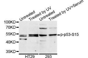 Western blot analysis of extracts of HT-29 cell line, using Phospho-p53-S15 antibody. (p53 抗体  (pSer15))