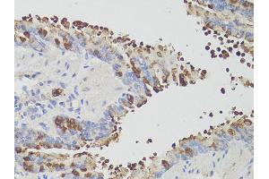 Immunohistochemistry of paraffin-embedded mouse bronchial epithelium using PDCD1 antibody (ABIN6290170) at dilution of 1:200 (40x lens). (PD-1 抗体)