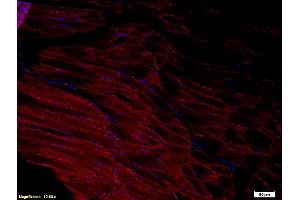 Formalin-fixed and paraffin-embedded rat tongue labeled with Anti-ADAMTS1 Polyclonal Antibody, Unconjugated (ABIN673404) 1:200, overnight at 4°C, The secondary antibody was Goat Anti-Rabbit IgG, Cy3 conjugated used at 1:200 dilution for 40 minutes at 37°C. (ADAMTS1 抗体  (AA 851-967))