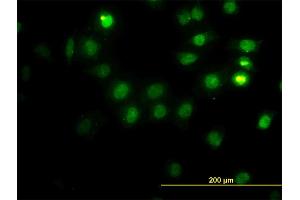 Immunofluorescence of monoclonal antibody to CSE1L on HeLa cell. (Exportin 2 抗体  (AA 872-971))