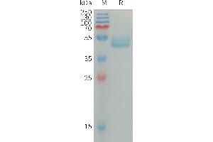 SDS-PAGE (SDS) image for Interleukin 4 (IL4) (AA 25-153) protein (mFc Tag) (ABIN7538345)