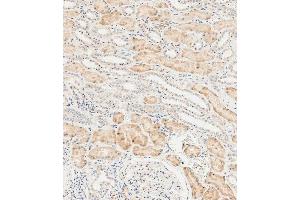 Immunohistochemical analysis of paraffin-embedded human kidney tissue using  performed on the Leica® BOND RXm. (LZIC 抗体  (AA 81-109))