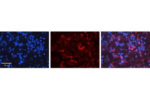 Rabbit Anti-PRKCD Antibody Catalog Number: ARP56701_P050 Formalin Fixed Paraffin Embedded Tissue: Human Lymph Node Tissue Observed Staining: Cytoplasm Primary Antibody Concentration: 1:600 Other Working Concentrations: N/A Secondary Antibody: Donkey anti-Rabbit-Cy3 Secondary Antibody Concentration: 1:200 Magnification: 20X Exposure Time: 0. (PKC delta 抗体  (N-Term))