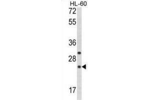 Western Blotting (WB) image for anti-Regulator of G-Protein Signaling 1 (RGS1) antibody (ABIN3003898) (RGS1 抗体)