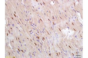 Formalin-fixed and paraffin embedded rat heart labeled with Anti Glucagon Receptor Polyclonal Antibody, Unconjugated (ABIN751528) followed by conjugation to the secondary antibody and DAB staining (Glucagon Receptor 抗体  (AA 11-110))