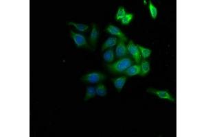 Immunofluorescence staining of HepG2 cells with ABIN7143311 at 1:133, counter-stained with DAPI. (AHCY 抗体  (AA 2-432))