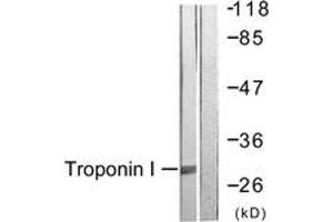 Western Blotting (WB) image for anti-Cardiac Troponin I (TNNI3) (AA 11-60) antibody (ABIN2888778) (TNNI3 抗体  (AA 11-60))