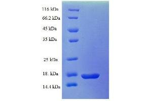 Luteinizing Hormone beta Polypeptide (LHB) (AA 21-141) protein (His tag) expressed in E.