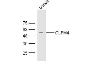 Olfactomedin 4 抗体  (AA 111-510)