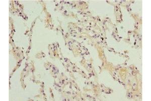 Immunohistochemistry of paraffin-embedded human lung tissue using ABIN7150982 at dilution of 1:100 (ARIH2 抗体  (AA 194-493))