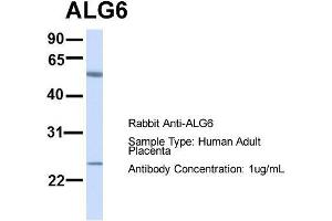 Host:  Rabbit  Target Name:  ALG6  Sample Type:  Human Adult Placenta  Antibody Dilution:  1. (ALG6 抗体  (N-Term))