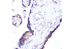 Immunohistochemistry of paraffin-embedded human placenta using RRAGA Rabbit pAb (ABIN7269878) at dilution of 1:100 (40x lens). (RRAGA 抗体  (AA 1-160))