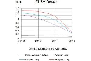Black line: Control Antigen (100 ng),Purple line: Antigen (10 ng), Blue line: Antigen (50 ng), Red line:Antigen (100 ng) (Progesterone Receptor 抗体  (AA 166-411))