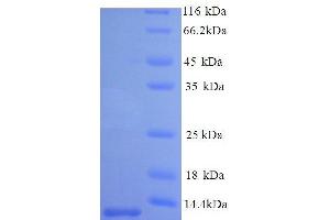 SDS-PAGE (SDS) image for Surfactant Protein B (SFTPB) (AA 188-266) protein (His tag) (ABIN7586137)