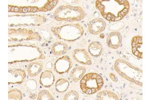 Immunohistochemistry (IHC) image for anti-Keratin 10 (KRT10) (AA 153-456) antibody (ABIN7433948)