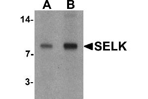 Western blot analysis of SELK in A20 cell lysate with SELK antibody at (A) 1 and (B) 2 µg/mL. (Selenoprotein K 抗体  (C-Term))