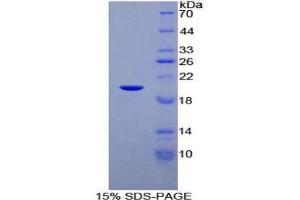SDS-PAGE analysis of Human C/EBP gamma Protein. (CEBPG 蛋白)