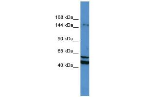 WB Suggested Anti-ZMYM3 Antibody Titration: 0. (ZMYM3 抗体  (N-Term))