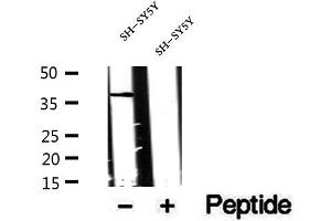 Western blot analysis of extracts of SH-SY5Y cells, using CXXC5 antibody. (CXXC5 抗体)