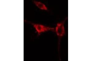 ABIN6275467 staining  HuvEc cells by IF/ICC. (RAB37 抗体  (C-Term))