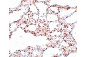 Immunohistochemical staining of rat lung tissue with ZSCAN4 polyclonal antibody  at 5 ug/mL dilution. (ZSCAN4 抗体  (C-Term))