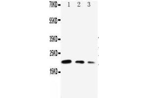 Anti-CDC42 antibody, Western blotting Lane 1: Recombinant Human CDC42 Protein 10ng Lane 2: Recombinant Human CDC42 Protein 5ng Lane 3: Recombinant Human CDC42 Protein 2. (CDC42 抗体  (Middle Region))
