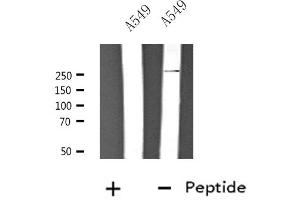 Western blot analysis of extracts from A549 cells, using CACNA1H antibody. (CACNA1H 抗体  (Internal Region))