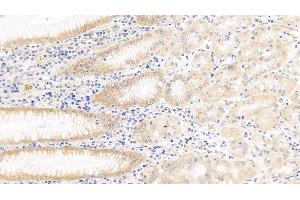 Detection of Surv in Human Stomach Tissue using Polyclonal Antibody to Survivin (Surv) (Survivin 抗体  (AA 1-142))