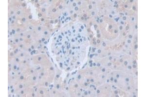 Detection of ITSN1 in Rat Kidney Tissue using Polyclonal Antibody to Intersectin 1 (ITSN1) (ITSN1 抗体  (AA 1-227))
