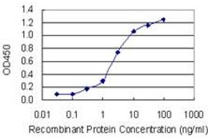 Detection limit for recombinant GST tagged PHIP is 0. (PHIP 抗体  (AA 1599-1705))