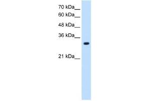 SLC7A8 antibody used at 1. (SLC7A8 抗体)
