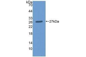Detection of Recombinant ME2, Human using Polyclonal Antibody to Malic Enzyme 2, NADP+ Dependent, Mitochondrial (ME2) (Malic Enzyme 2, NADP+ Dependent, Mitochondrial (AA 220-426) 抗体)