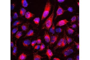 IF analysis of MTUS1 using anti-MTUS1 antibody (ABIN6719607).