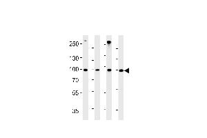 HSPCB Antibody (N-term) (ABIN1882093 and ABIN2842648) western blot analysis in A431,H-4-II-E,Hela,rat L6 cell line lysates (35 μg/lane). (HSP90AB1 抗体  (N-Term))