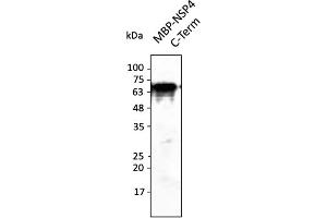 Western Blotting (WB) image for anti-SARS-CoV-2 Non-Structural Protein 4 (NSP4) (C-Term) antibody (ABIN7272999) (SARS-CoV-2 NSP4 抗体  (C-Term))