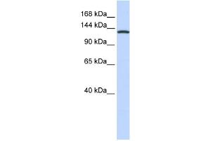 WB Suggested Anti-VARS Antibody Titration:  0. (VARS 抗体  (Middle Region))