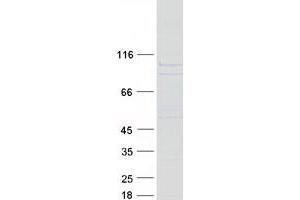 Western Blotting (WB) image for Spermatogenesis Associated 7 (SPATA7) (Transcript Variant 2) protein (Myc-DYKDDDDK Tag) (ABIN2732531)
