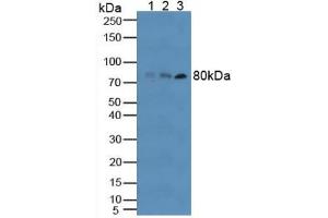 Western blot analysis of (1) Human RAW2647 Cells, (2) Human HT-1080 Cells and (3) Human Blood Cells. (TLR6 抗体  (AA 608-796))