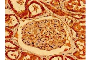 Immunohistochemistry of paraffin-embedded human kidney tissue using ABIN7161298 at dilution of 1:100 (NOTCH2 抗体  (AA 59-250))