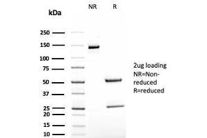 SDS-PAGE Analysis Purified TAG-72 Recombinant Mouse Monoclonal Antibody (rB72. (Recombinant TAG-72 / CA72.4 抗体)