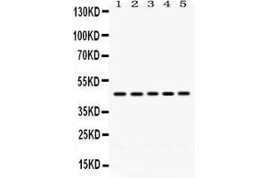 Anti- PGK1 Picoband antibody, Western blottingAll lanes: Anti PGK1  at 0. (PGK1 抗体  (C-Term))