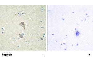 Immunohistochemistry analysis of paraffin-embedded human brain tissue, using NKTR polyclonal antibody . (NKTR 抗体)
