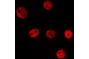 ABIN6275604 staining Hela by IF/ICC. (SF3B4 抗体  (N-Term))