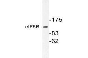 Western blot (WB) analysis of eIF5B antibody in extracts from Jurkat cells.