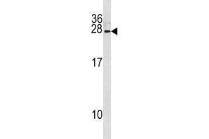 Western Blotting (WB) image for anti-Interferon, alpha 8 (IFNA8) antibody (ABIN3004546) (IFNA8 抗体)